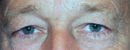 Before ā Age 50